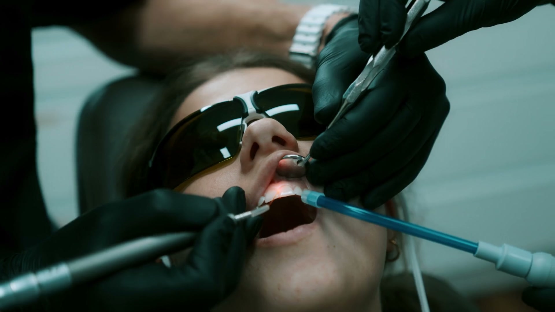 Laserbehandlung: Patientin mit Schutzbrille während der Lasertherapie